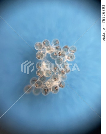 メダカの卵 孵化までの観察 9日目 メダカの卵 孵化までの観察 9日目 76526893