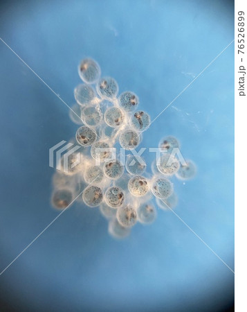 メダカの卵 孵化までの観察 6日目 メダカの卵 孵化までの観察 6日目 76526899