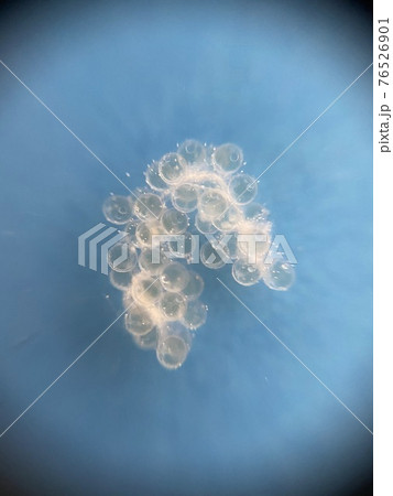 メダカの卵 孵化までの観察 3日目 メダカの卵 孵化までの観察 3日目 76526901