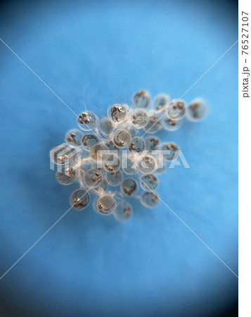 メダカの卵 孵化までの観察 13日目 メダカの卵 孵化までの観察 13日目 76527107