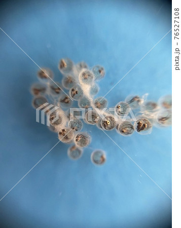 メダカの卵 孵化までの観察 12日目 メダカの卵 孵化までの観察 12日目 76527108