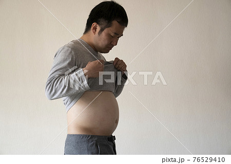 メタボの男性 メタボの男性 76529410