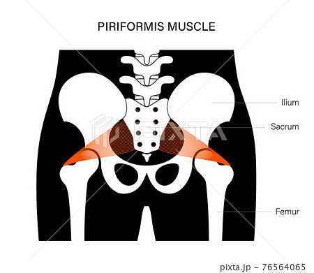 Muscular pelvis concept 76564065