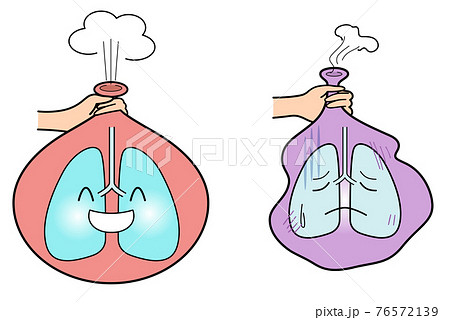 元気な肺と元気のない肺を風船で例えるのイラスト素材