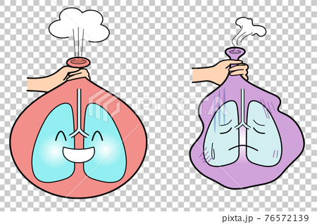元気な肺と元気のない肺を風船で例えるのイラスト素材