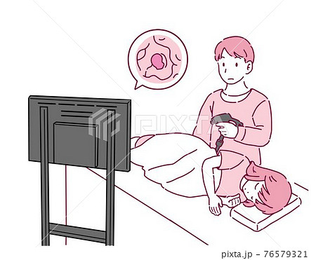 大腸がん検査を行う女性のイラスト 76579321
