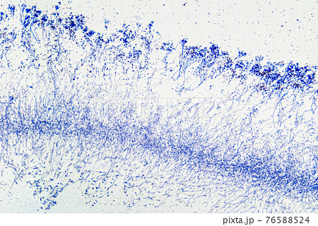 Penicillium, ascomycetous fungi, under a microscope. Mycelium, the vegetative part of the fungus, a mass of branching, thread-like hyphae. Used for antibiotics, fermenting, beverages and cheese. Photo 76588524
