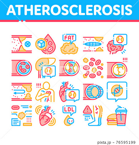 Atherosclerosis Vessel Collection Icons Set Vector Illustrations Atherosclerosis Vessel Collection Icons Set Vector Illustrations 76595199