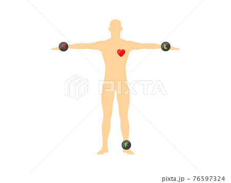 Einthoven ECG triangle, including augmented unipolar limb lead 76597324