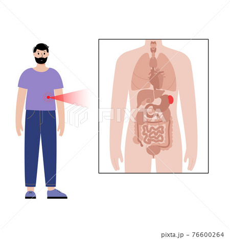 Pain in male body 76600264