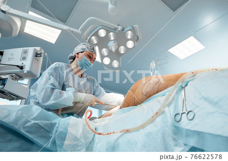cosmetic liposuction surgery in actual operating room setting showing surgeons group during operation cosmetic liposuction surgery in actual operating room setting showing surgeons group during operation 76622578