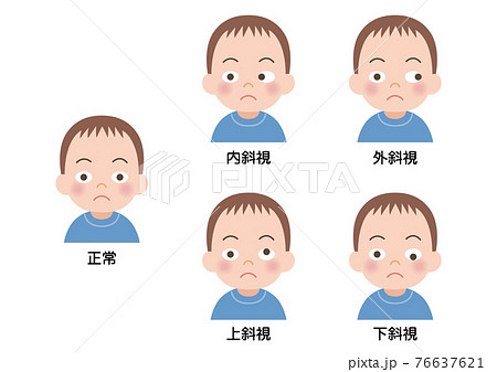 斜視の男の子のイラスト 76637621