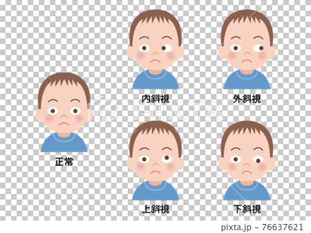 斜視の男の子のイラスト 76637621