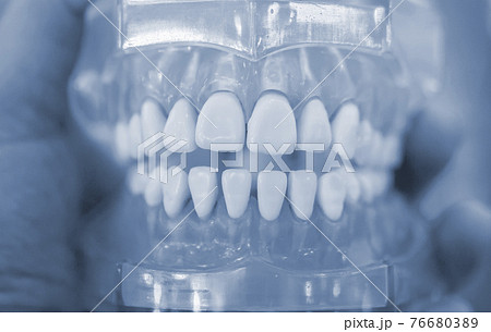 Model of human teeth of the human jaw close-up. Model of human teeth of the human jaw close-up. 76680389