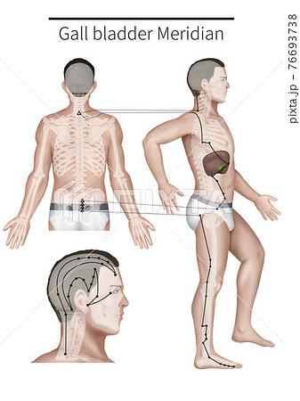 経絡 鍼治療 漢方医学 76693738
