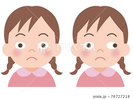 斜視の女の子のイラスト 76727218