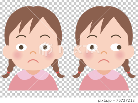 斜視の女の子のイラスト 76727218