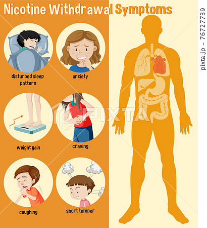 what are tobacco withdrawal symptoms Nicotine Withdrawal Symptoms Infographic - Stock Illustration [76727739]