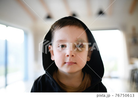 Poor sad small boy with cut eyebrow standing indoors at home, poverty concept. Poor sad small boy with cut eyebrow standing indoors at home, poverty concept. 76750613