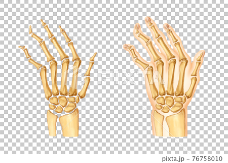 手和關節炎的解剖 76758010