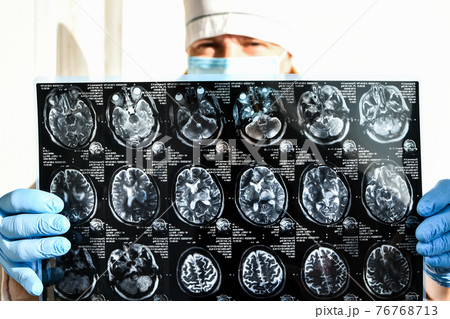 Doctor in protecting gloves holding brain MRI in medical office. MRI scan of human head in clinic. 76768713