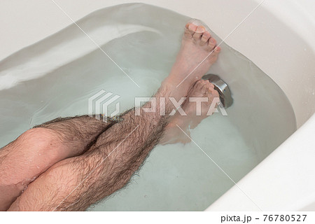 メンズ　脚脱毛　beforeイメージ 76780527