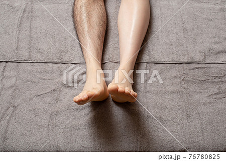 メンズ　脚脱毛　before & afterイメージ　片脚のみ 76780825