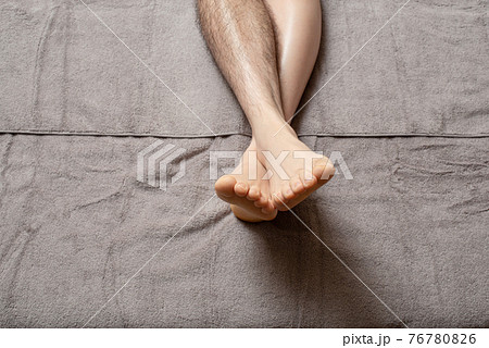 メンズ　脚脱毛　before & afterイメージ　片脚のみ 76780826