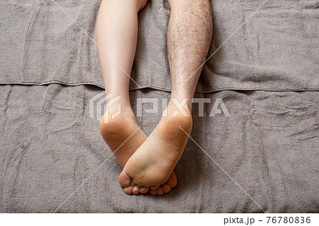 メンズ 脚脱毛 before & afterイメージ 片脚のみ メンズ 脚脱毛 before & afterイメージ 片脚のみ 76780836