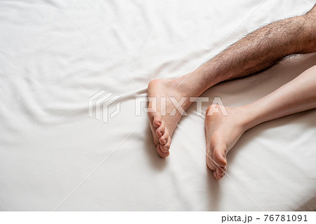 メンズ　脚脱毛　before & afterイメージ　片脚のみ 76781091