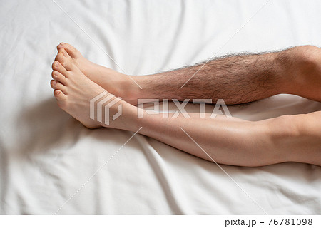 メンズ 脚脱毛 before & afterイメージ 片脚のみ メンズ 脚脱毛 before & afterイメージ 片脚のみ 76781098