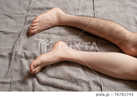 メンズ　脚脱毛　before & afterイメージ　片脚のみ 76781743