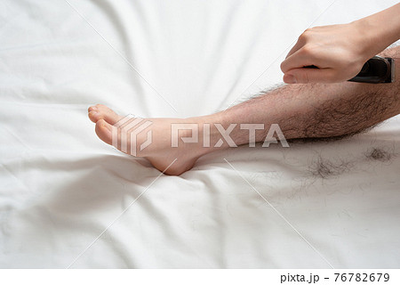 メンズ　脚脱毛　before & afterイメージ　片脚のみ 76782679