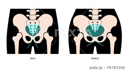 Muscular pelvis xray Muscular pelvis xray 76785506
