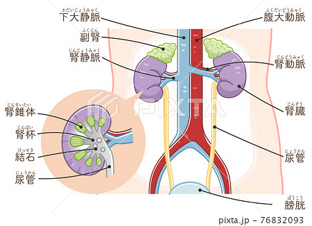 腎臓 尿管 膀胱 腎臓結石のイラスト テキスト付き のイラスト素材 7693