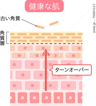 ターンオーバー 肌の断面図のイラスト素材