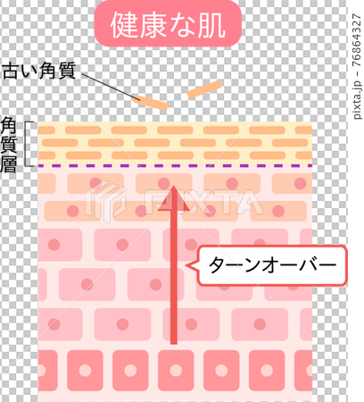 Turnover skin cross section 76864327