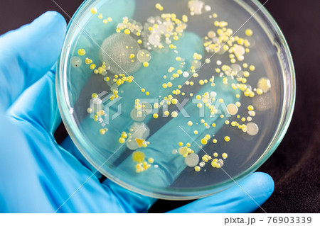 Backgrounds of Characteristics and Different shaped Colony of Bacteria and Mold growing on agar plates from Soil samples for education in Microbiology laboratory. 76903339