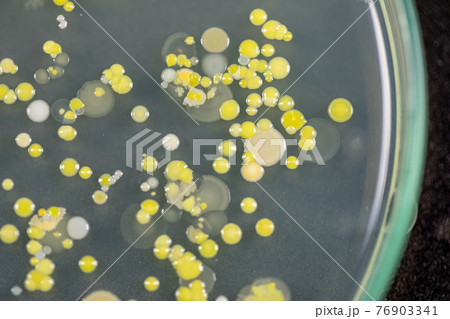 Backgrounds of Characteristics and Different shaped Colony of Bacteria and Mold growing on agar plates from Soil samples for education in Microbiology laboratory. Backgrounds of Characteristics and Different shaped Colony of Bacteria and Mold growing on agar plates from Soil samples for education in Microbiology laboratory. 76903341