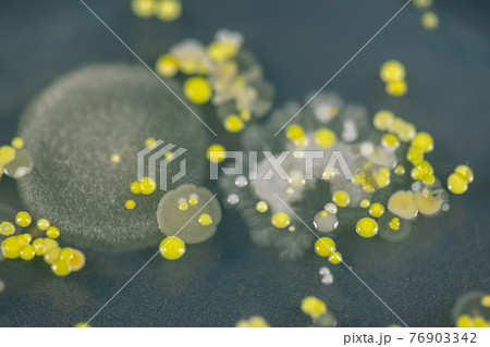 Backgrounds of Characteristics and Different shaped Colony of Bacteria and Mold growing on agar plates from Soil samples for education in Microbiology laboratory. Backgrounds of Characteristics and Different shaped Colony of Bacteria and Mold growing on agar plates from Soil samples for education in Microbiology laboratory. 76903342
