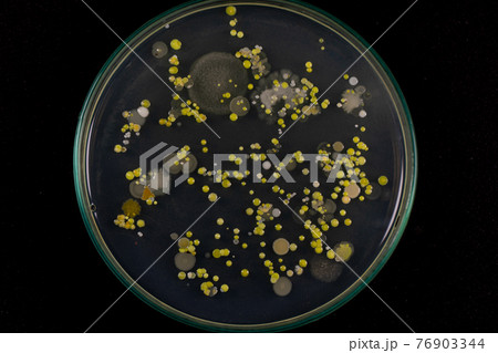 Backgrounds of Characteristics and Different shaped Colony of Bacteria and Mold growing on agar plates from Soil samples for education in Microbiology laboratory. 76903344