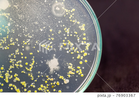 Backgrounds of Characteristics and Different shaped Colony of Bacteria and Mold growing on agar plates from Soil samples for education in Microbiology laboratory. 76903367
