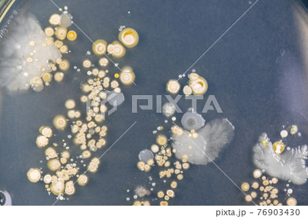 Backgrounds of Characteristics and Different shaped Colony of Bacteria and Mold growing on agar plates from Soil samples for education in Microbiology laboratory. 76903430