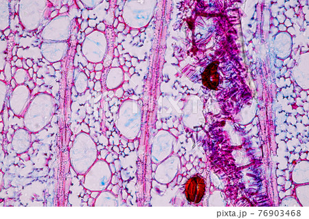 Characteristics of fungi living in wood as a group, are polyphyletic under the microscope for education. Characteristics of fungi living in wood as a group, are polyphyletic under the microscope for education. 76903468