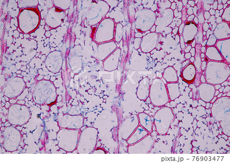 Characteristics of fungi living in wood as a group, are polyphyletic under the microscope for education. 76903477