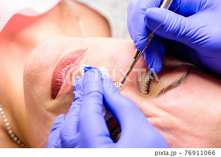 Mechanical cleansing of the face with a spoon uno, removing grease and blackheads. 76911066