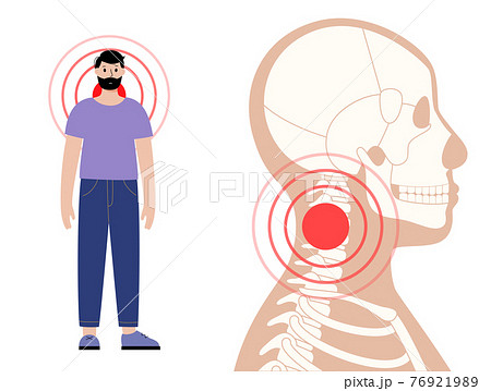 Pain in neck 76921989