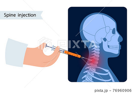 Spine joint injection  76960906