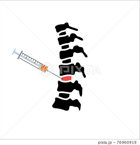 Spine joint injection  76960919