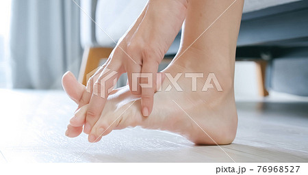 Woman scratch her athletes foot Woman scratch her athletes foot 76968527